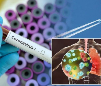 Վրաստանում գրանցվել է կորոնավիրուսով վարակման 3656 նոր դեպք, ևս 32 հիվանդ մահացել է