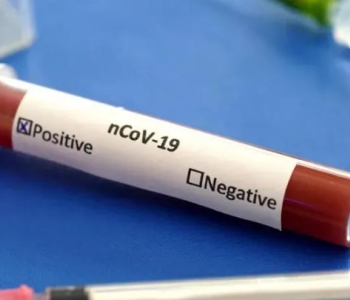 Gürcüstanda daha 153 nəfər koronavirusa yoluxub
